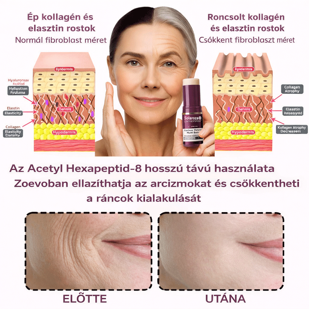 🔥  Első értékesítési termék Solaroza @ Calcium Polycollagen Improvement Cream - kalcium-ionokat, hexapeptid-8 és növényi kollagén kivonatokat tartalmaz, amelyek célzott hatást nyújtanak az egyes ráncokhoz - gyors javítás, 100% -os öregedésellenes hatás.