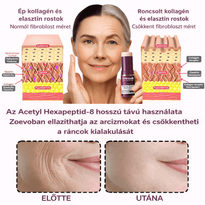 🔥  Első értékesítési termék Solaroza @ Calcium Polycollagen Improvement Cream - kalcium-ionokat, hexapeptid-8 és növényi kollagén kivonatokat tartalmaz, amelyek célzott hatást nyújtanak az egyes ráncokhoz - gyors javítás, 100% -os öregedésellenes hatás.