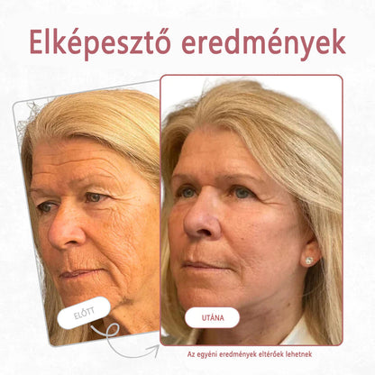 🔥  Első értékesítési termék Solaroza @ Calcium Polycollagen Improvement Cream - kalcium-ionokat, hexapeptid-8 és növényi kollagén kivonatokat tartalmaz, amelyek célzott hatást nyújtanak az egyes ráncokhoz - gyors javítás, 100% -os öregedésellenes hatás.